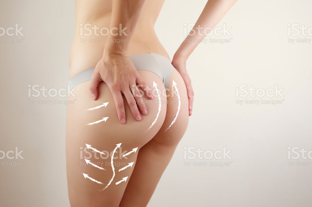 gluteos