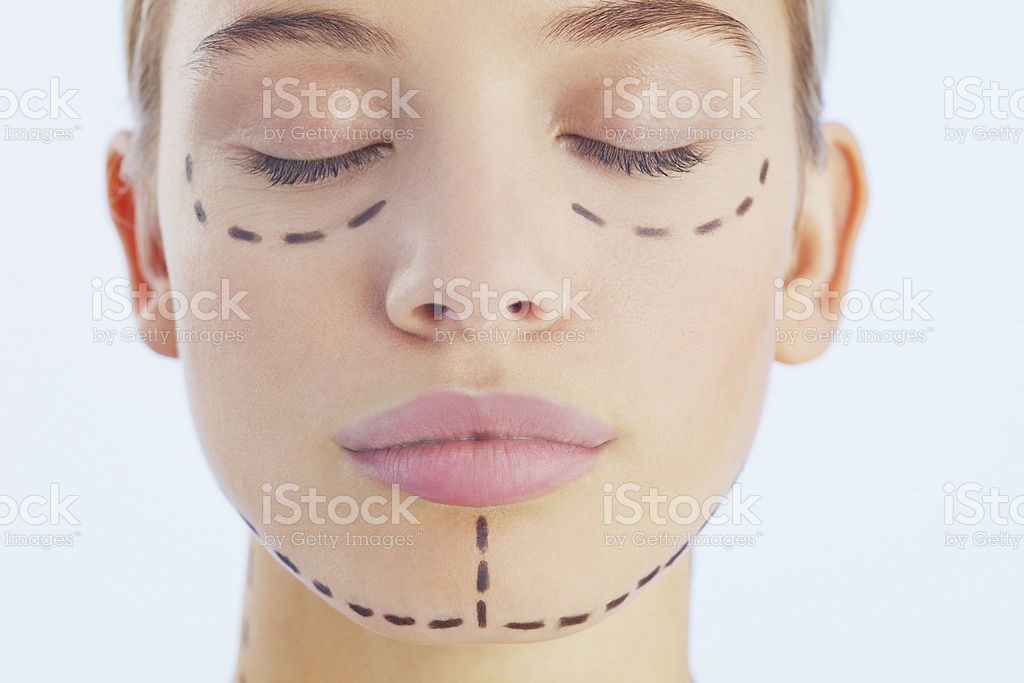 rostro